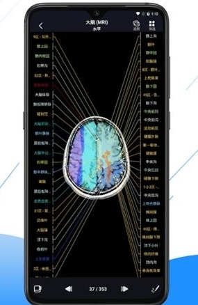影像解剖图谱app
